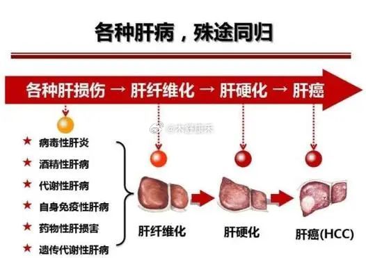 最新肝病治疗及步骤指南解析
